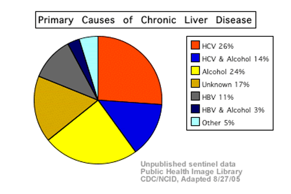 cirrhosis symptoms