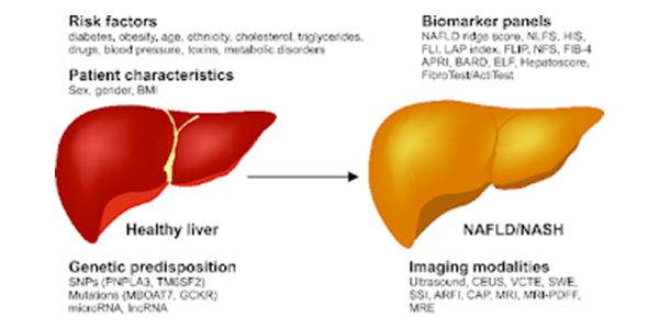 non‑alcoholic fatty liver disease