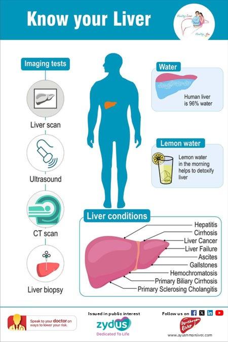Type 2 diabetes and MASLD