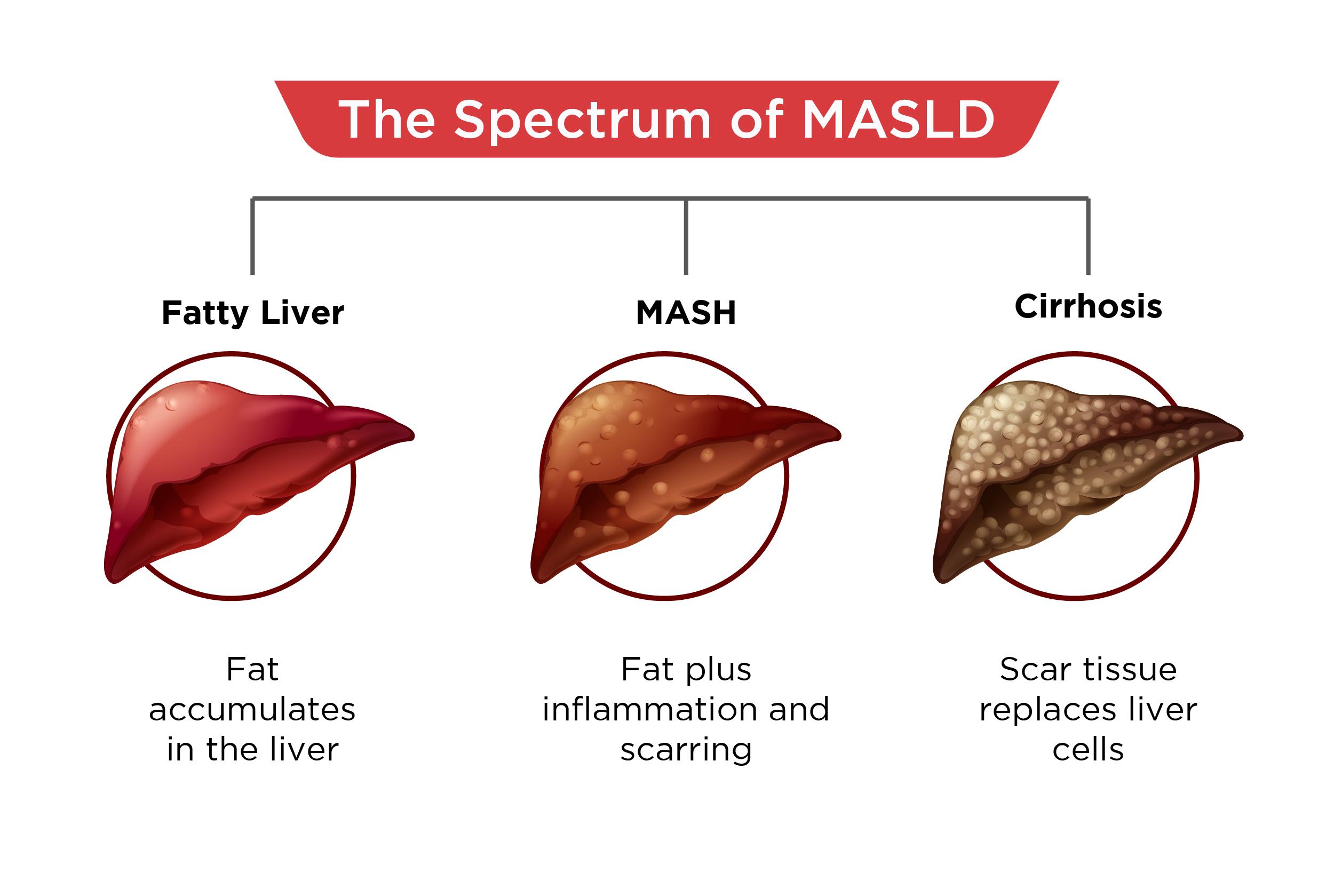 Metabolic dysfunction