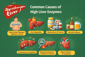 high liver enzymes